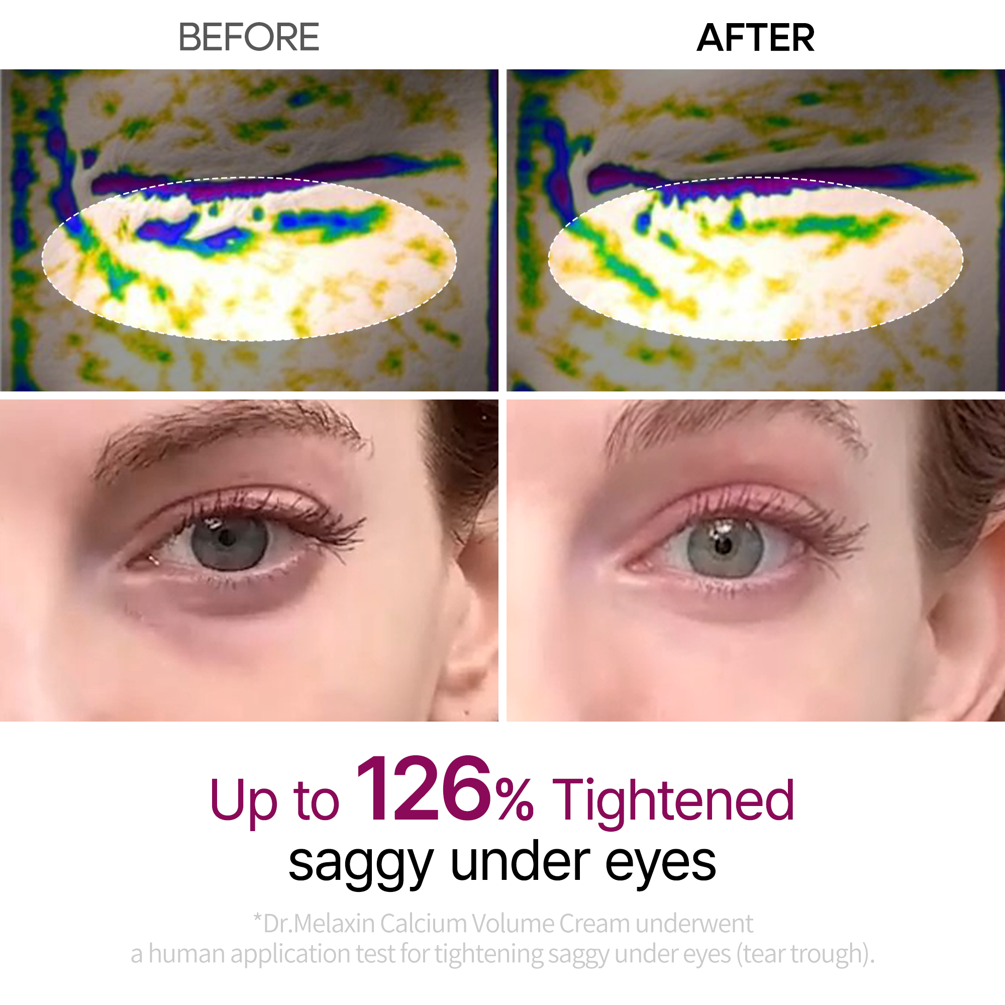 Calcium Eye care Line
