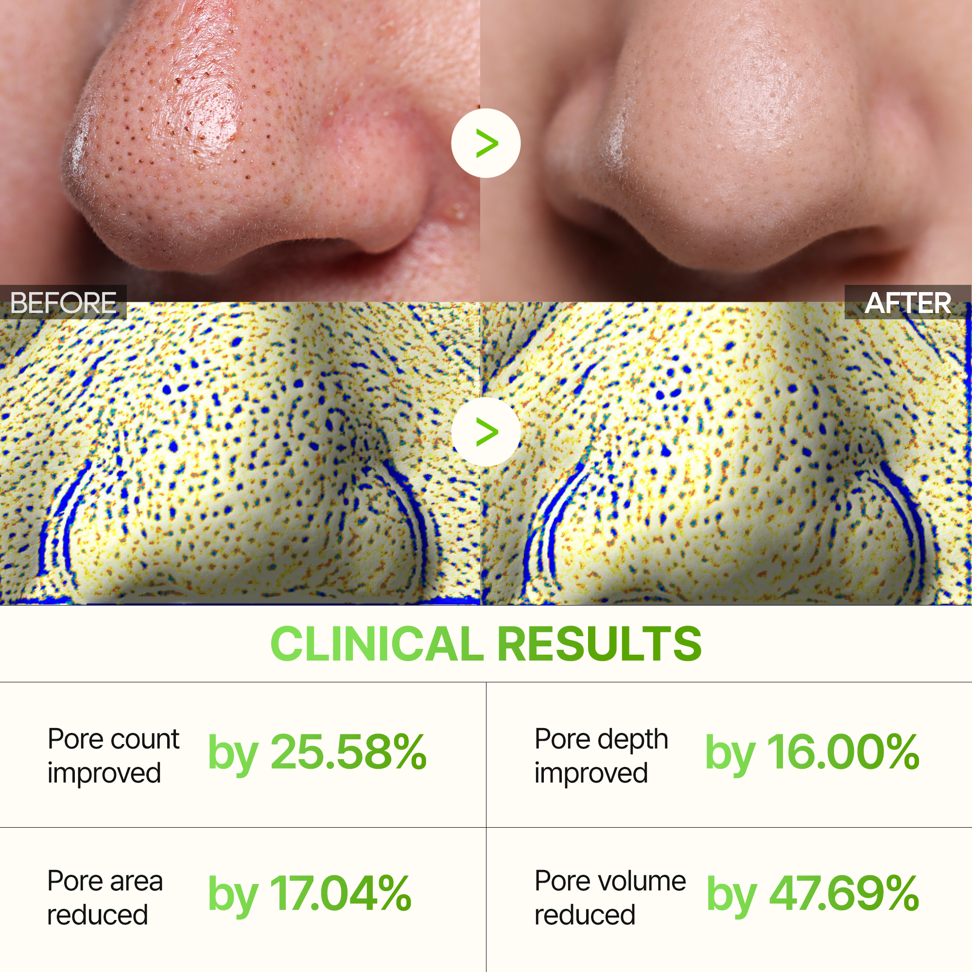 Cactox 3-Step Nose Mask Pack
