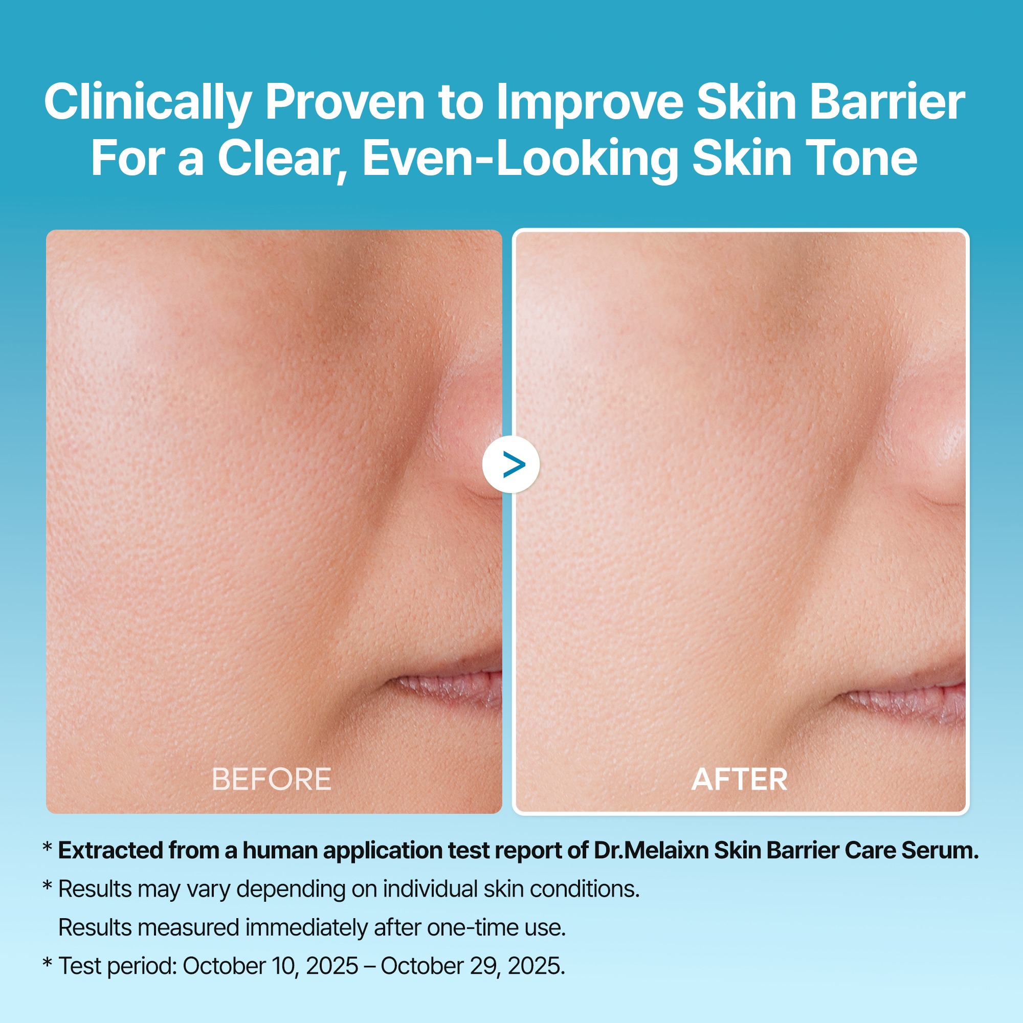 Peel Shot Exfoliating TX Serum
