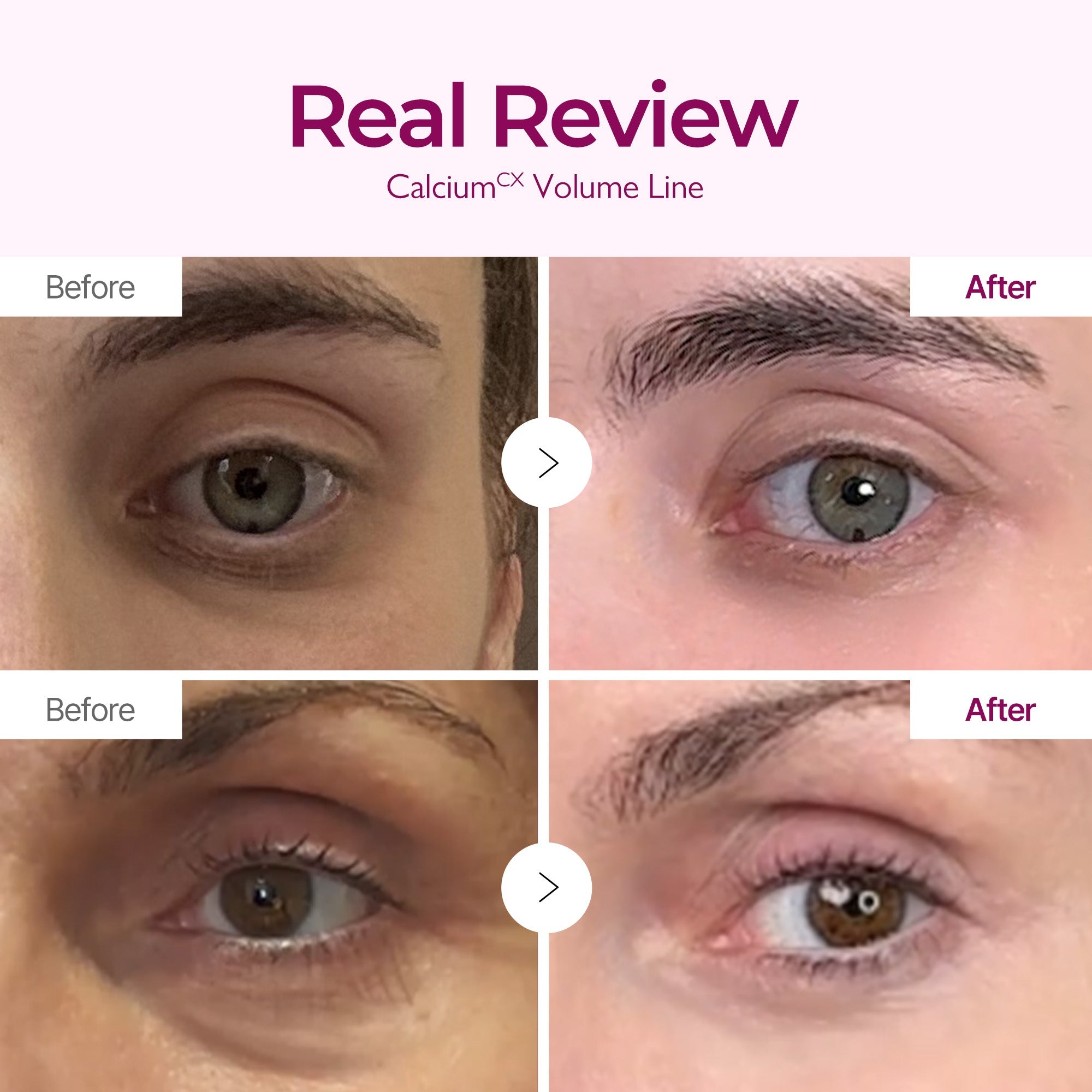Calcium Intense Cream