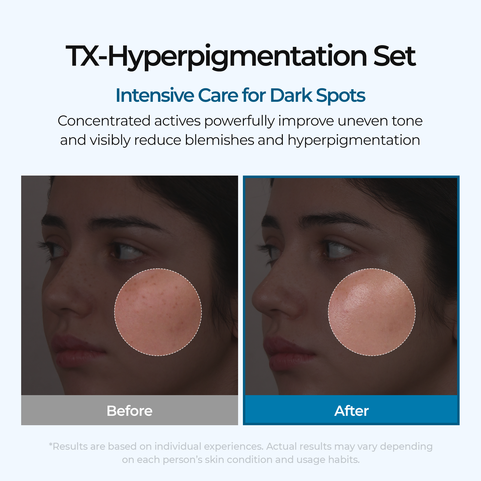 Dark Spot & Uneven Tone Peel Shot TX Duo