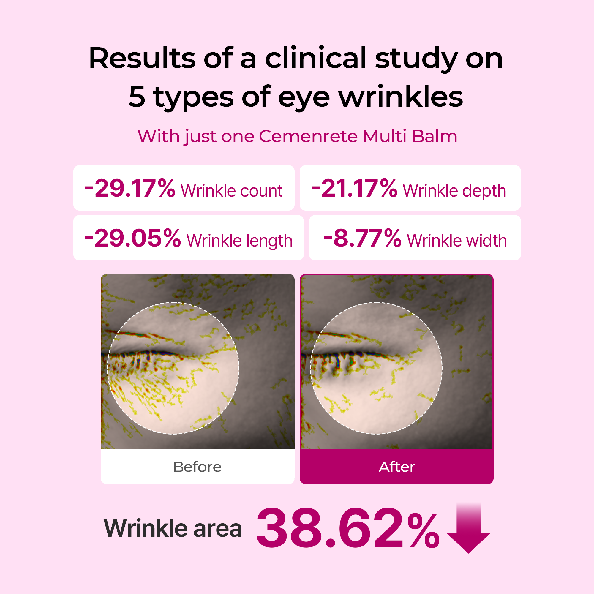 [Dr.Melaxin Exclusive] Gifted Collagen Boost Set — Eye Care Edition