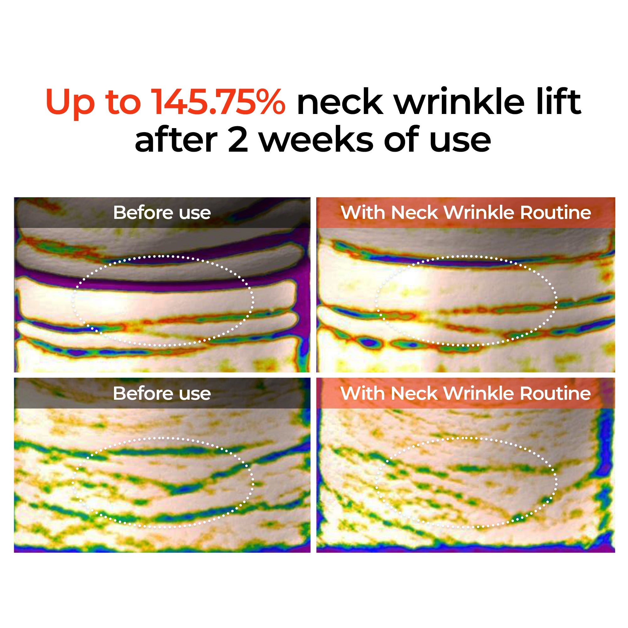 Calcium Boost Neck & Eye Set