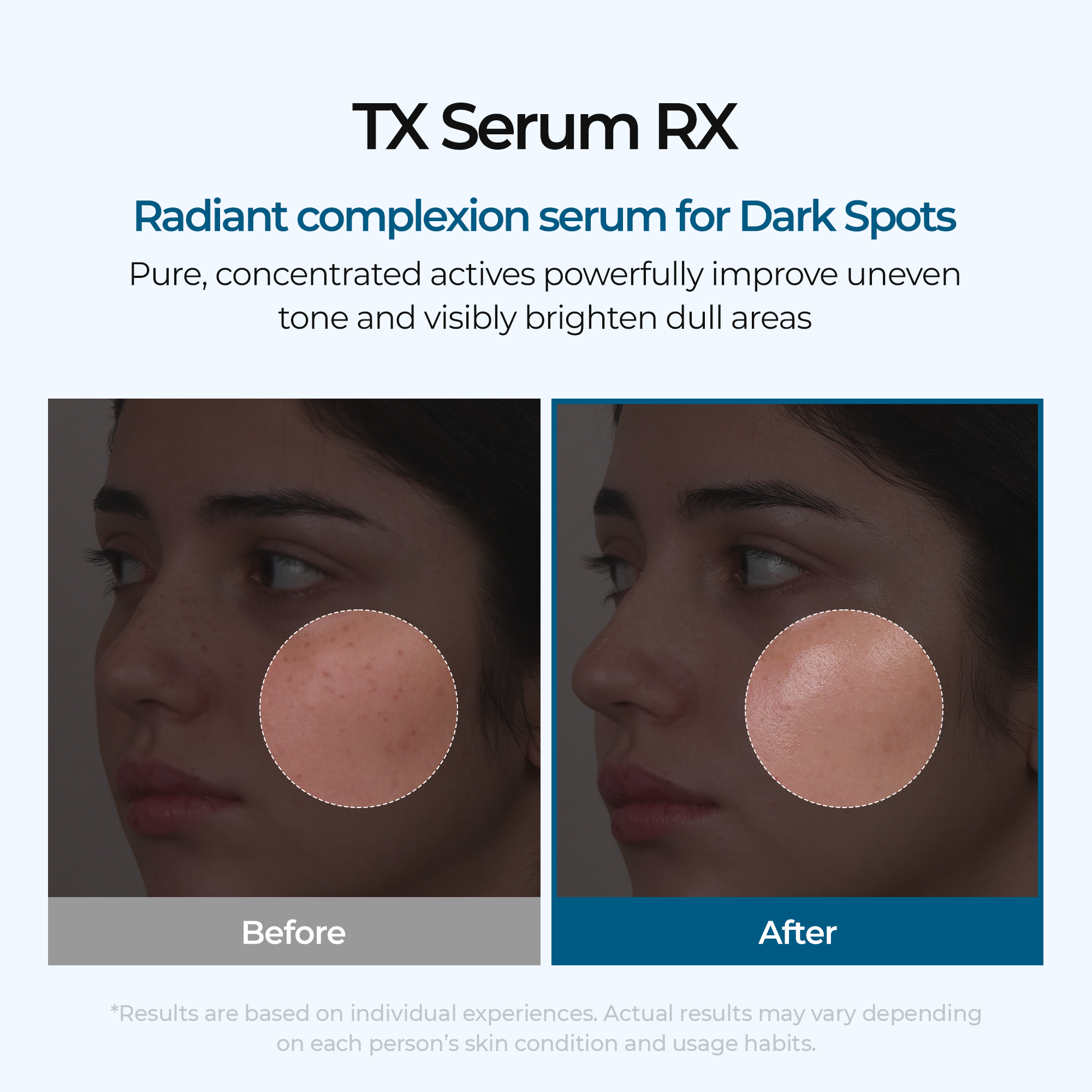 TX Ampoule Rx