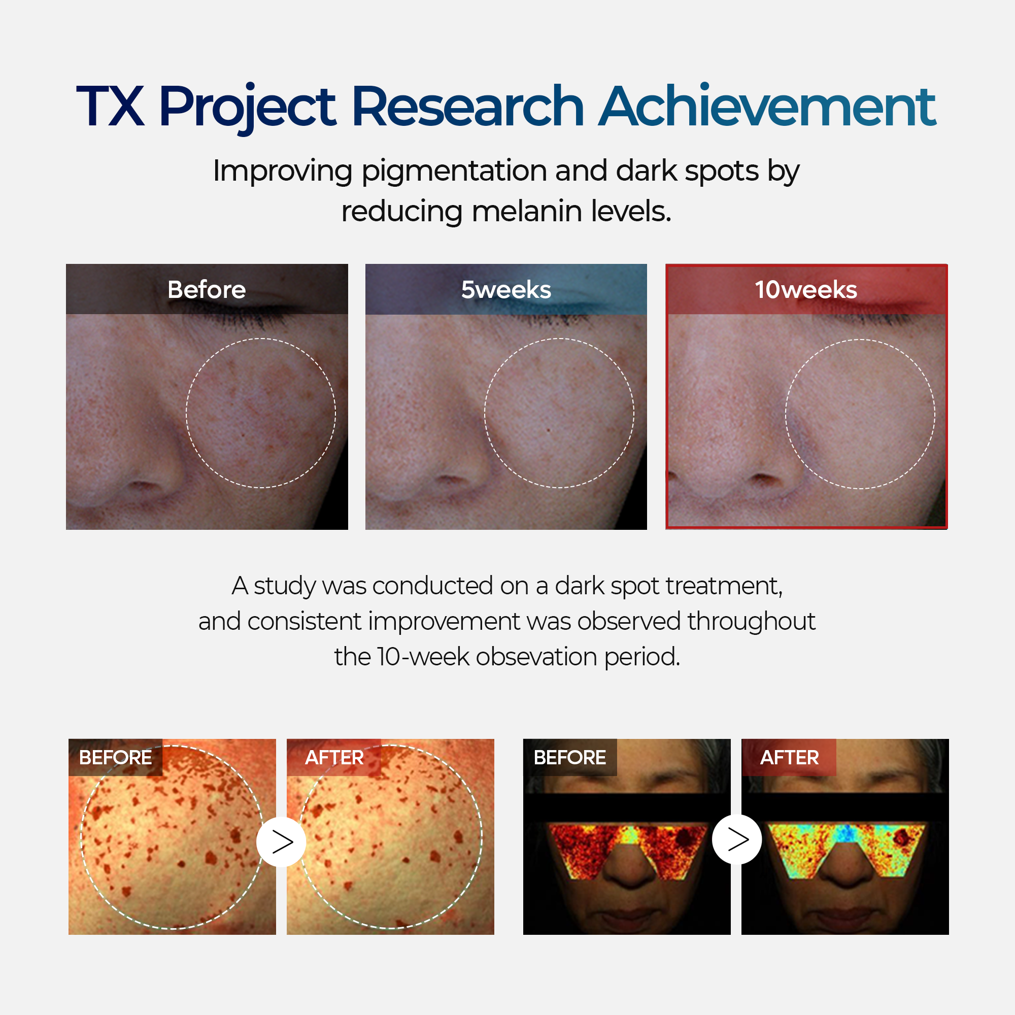 TX Tranexamic Acid Dark Spot Care Line