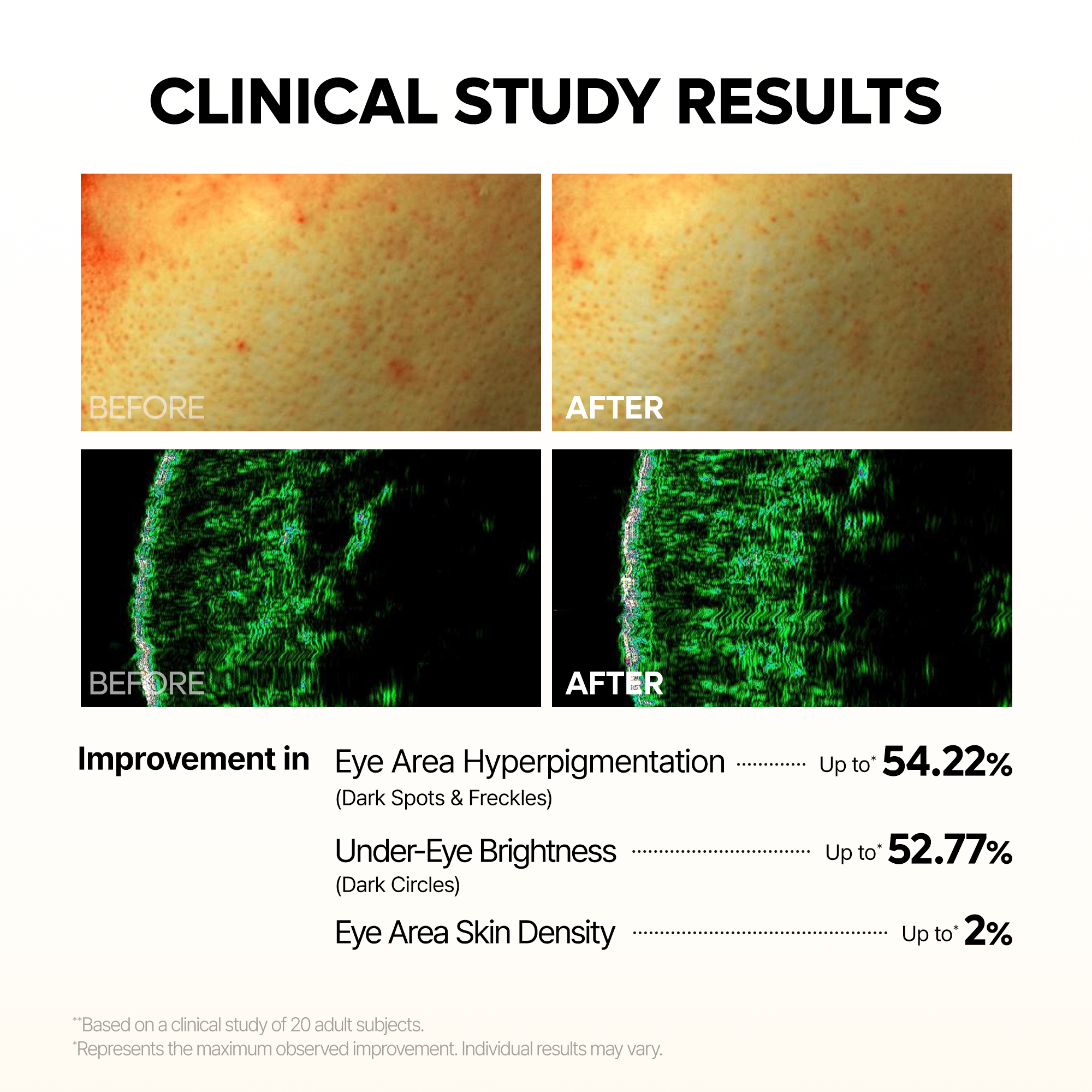 TX-Kojic Acid Retinal Eye patch